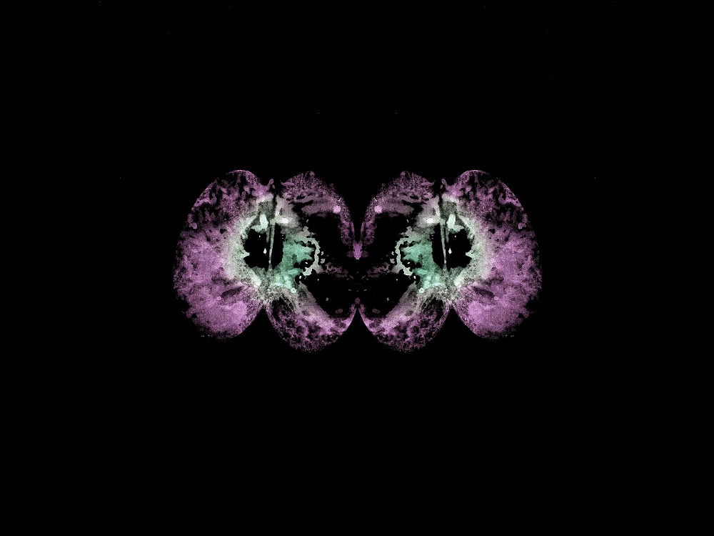 f p RMX #168
